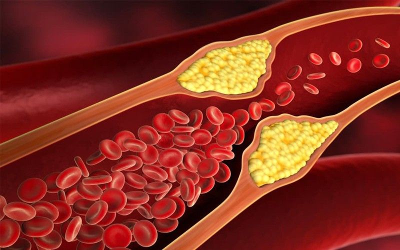 کلسترول خون | تمام اطلاعات درباره کلسترول بد (LDL) و کلسترول خوب (HDL)