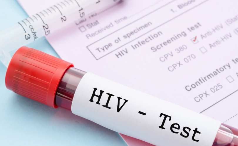اچ آی وی (HIV) و ایدز (AIDS) یکی نیستند | مراحل مختلف عفونت HIV