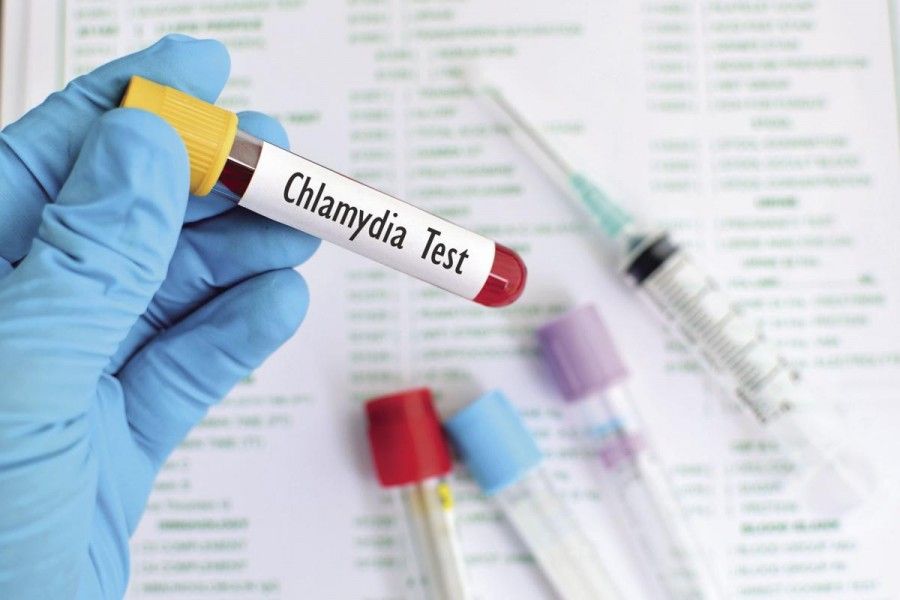 عفونت کلامیدیا تراکوماتیس | علائم و راه های درمان کلامیدیا
