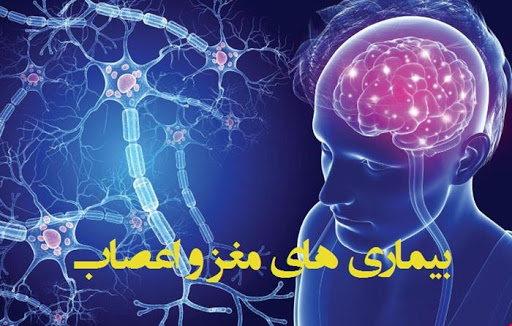 مهمترین بیماری های مغز و اعصاب که باید درباره آن بدانید