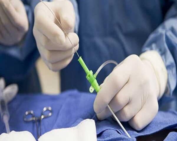 آنژیوگرافی قلب | آنژیوگرافی قلب برای تشخیص گرفتگی عروق حیاتی است