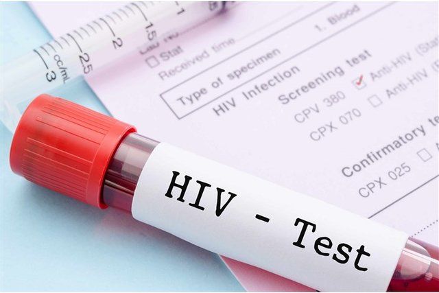 آیا بهترین زمان انجام آزمایش ایدز را می دانید؟