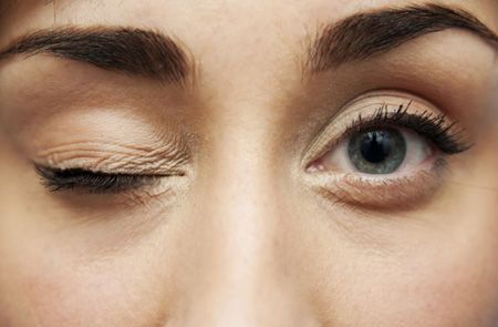تیک عصبی چشم | تیک عصبی چشم و تمام آنچه باید بدانید