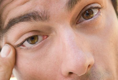 تیک عصبی چشم | تیک عصبی چشم و تمام آنچه باید بدانید