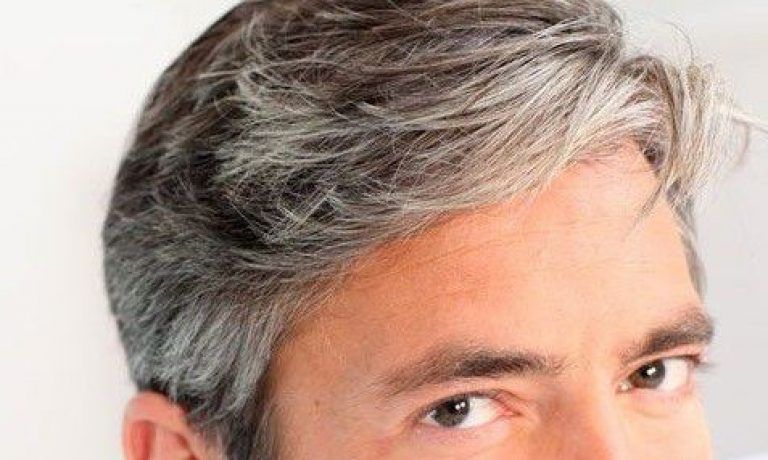سفیدی زودرس موها | اگر موهایتان در جوانی سفید شده دلایل و راه های درمان آن را بدانید