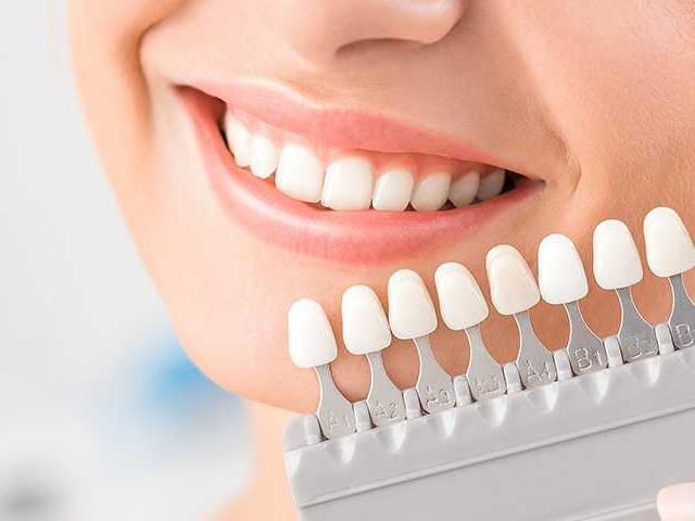 معایب و عوارض لمینت دندان که بسیار مهم است!