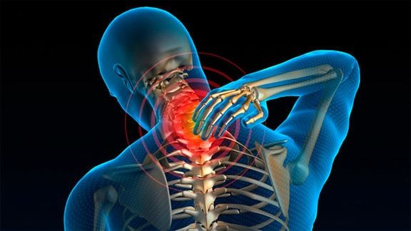 فتق یا بیرون زدگی دیسک گردن؛ انواع، علل و درمان های فتق دیسک گردن