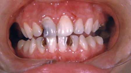 10 مشکل رایج دهان واقعاً چگونه به نظر می رسند؟