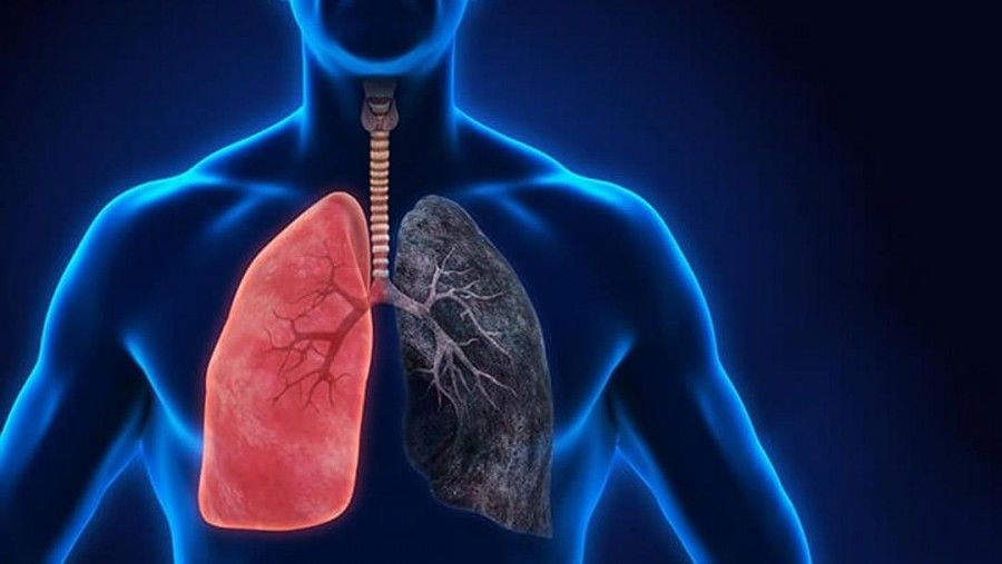 هر آنچه که باید در مورد بیماری مزمن انسدادی ریه (COPD) بدانید
