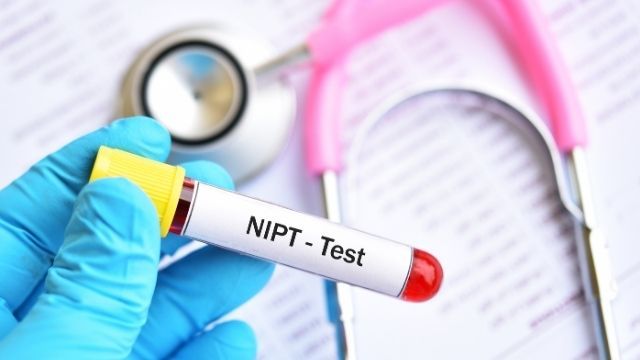 آزمایش سل فری (تست NIPT) چیست و چرا انجام می شود؟