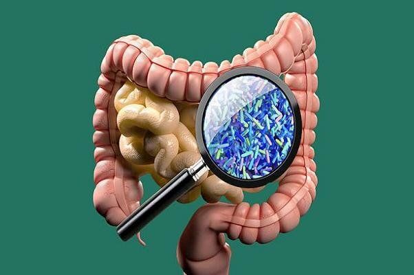 آیا می دانستید منشاء بیماری آلزایمر در روده هاست؟