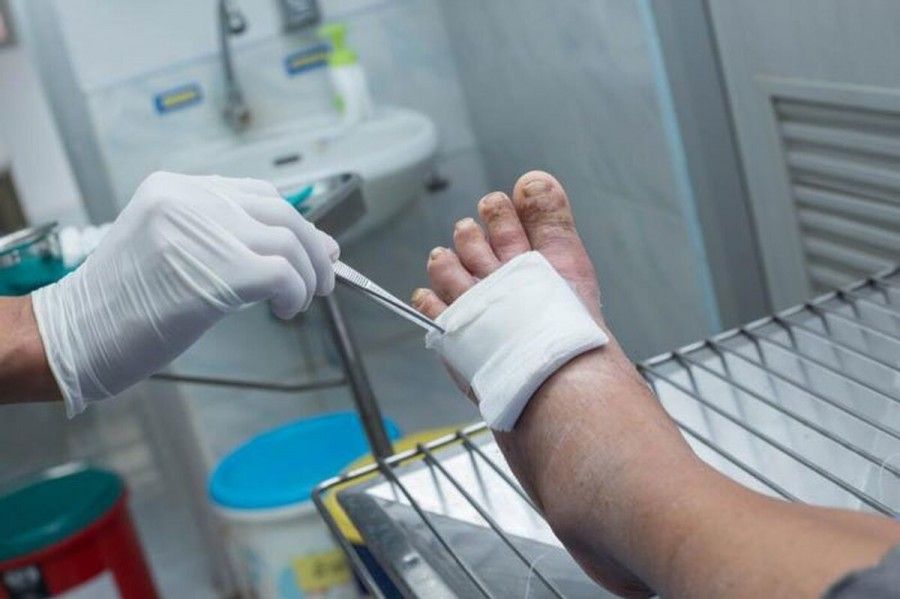 آیا می دانستید زخمهای دیابت، کشندهتر از سرطان هستند؟