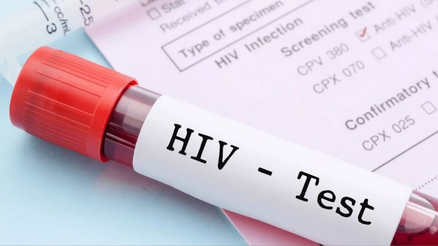 اثربخشی ۱۰۰ درصدی داروی جدید پیشگیری از HIV در آزمایش روی زنان