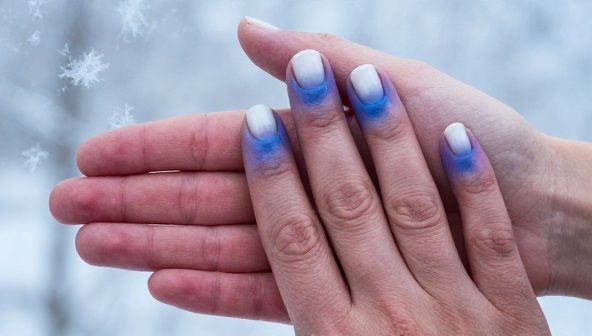 سندرم رینود چیست؟ | علت سردی غیرطبیعی دست و پا و روشهای درمان