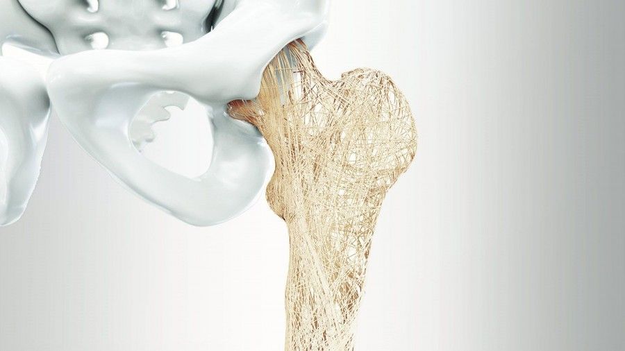 سنجش تراکم استخوان: پیشگیری و تشخیص زودهنگام پوکی استخوان