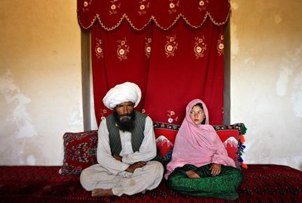 ازدواج زودهنگام کودکان |  آثار‌ سوء ازدواج زودهنگام بر سلامت کودکان