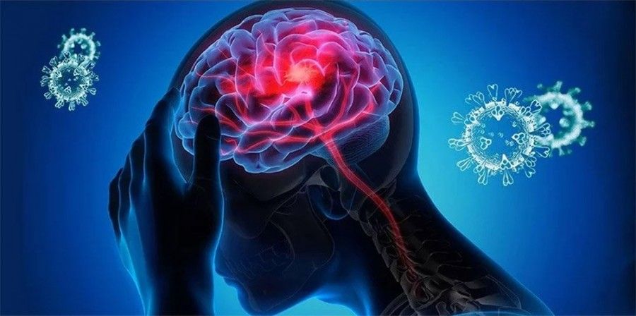 کرونا | تأثیر کرونا بر مغز و ضریب هوشی | نشانه های عصبی کرونا