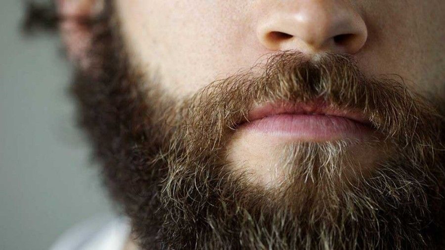 دلیل موخوره شدن ریش در آقایان چیست و چگونه درمان می شود؟