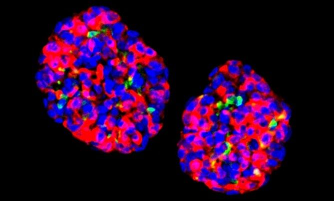  دانشمندان سلول‌های انسانی را برای ساختن انسولین هک کردند و دیابت را در موش‌ها درمان کردند