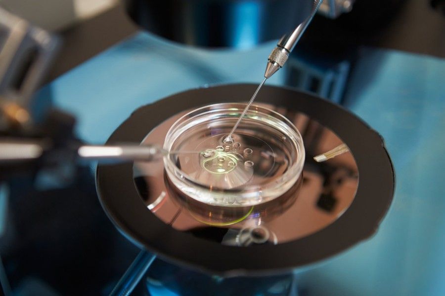 لقاح آزمایشگاهی (IVF)