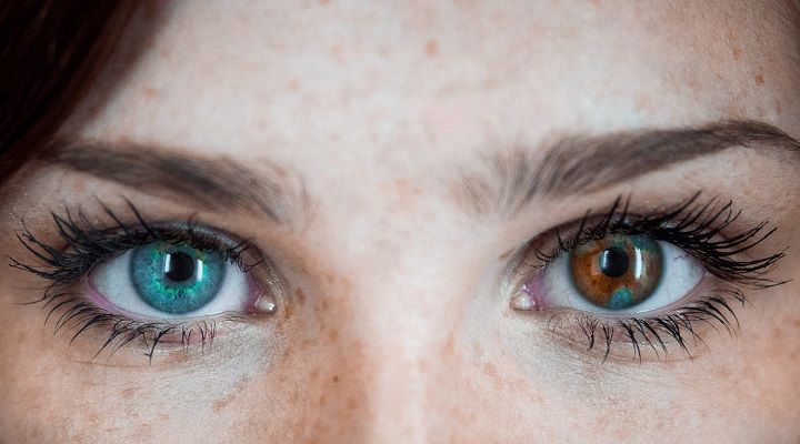 رنگ چشمان فرد مبتلا به هترکتومی