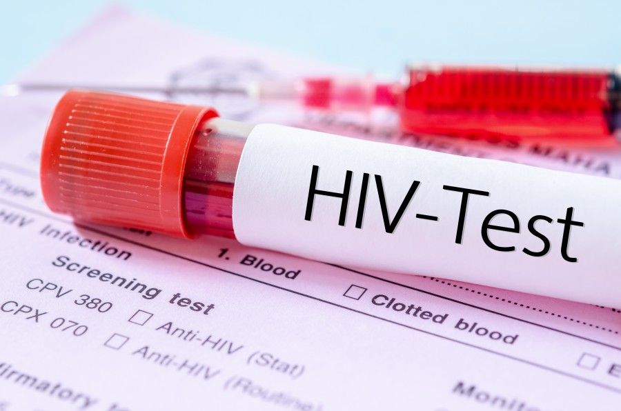 ضرورت آگاهی دانش آموزان درمورد HIV: دانستن نشانه ها برای شناسایی زودهنگام و مراقبت بهتر 