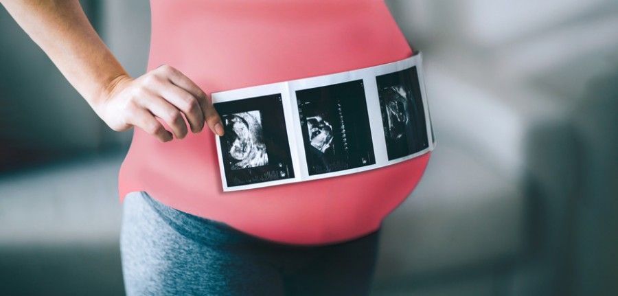   تأثیر سونوگرافی بر جنین: آیا استفاده از سونوگرافی در دوران بارداری برای جنین خطر دارد؟