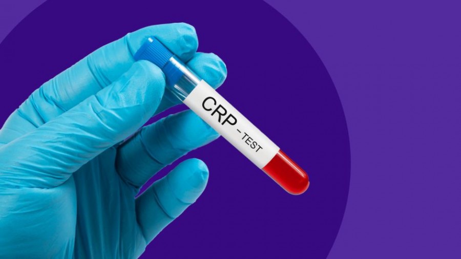 آزمایش CRP: تفسیر CRP در آزمایش خون چیست؟