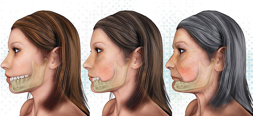 علت تحلیل استخوان فک: درمان آن چیست؟ 