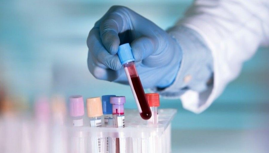  آزمایش TnT (Troponin T test) به چه منظوری در بیماران قلبی انجام می‌شود؟