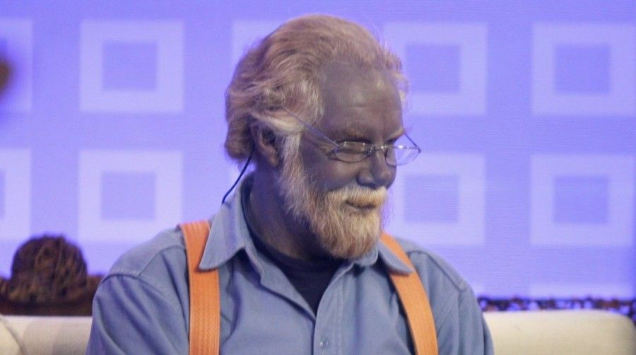 مردی با پوست آبی: ARGYRIA چیست؟