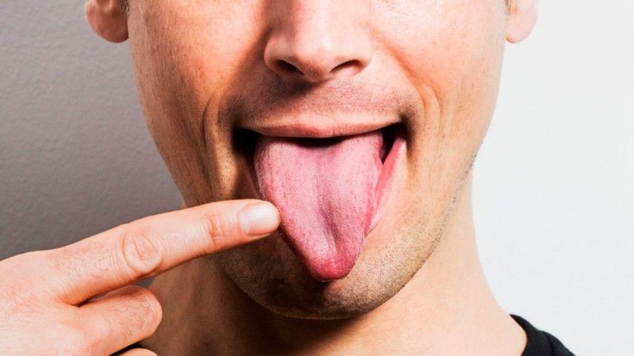 زبانتان در مورد سلامتی شما چه می گوید؟