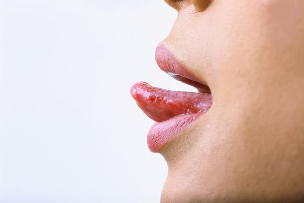زبانتان در مورد سلامتی شما چه می گوید؟