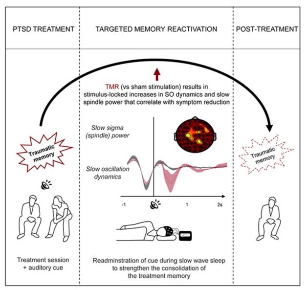  روش جدید و نوین برای کاهش علائم PTSD