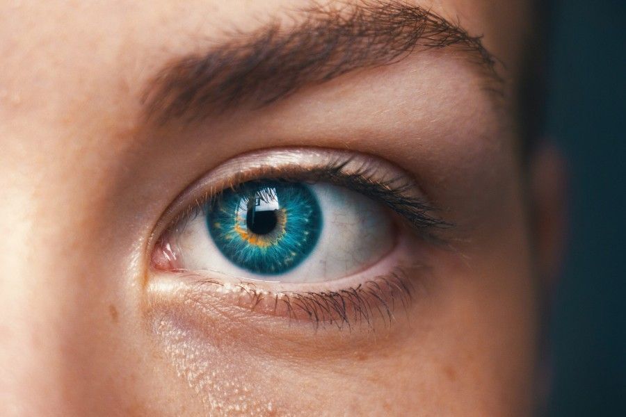 کراتوپیگمنتیشن: تغییر رنگ چشم و عوارض خطرناک آن