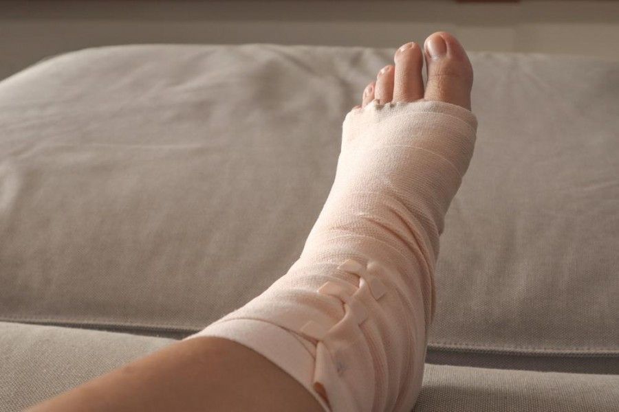 پیچخوردگی مچ پا و ارتباط آن با آسیبهای مغزی: آیا ممکن است؟
