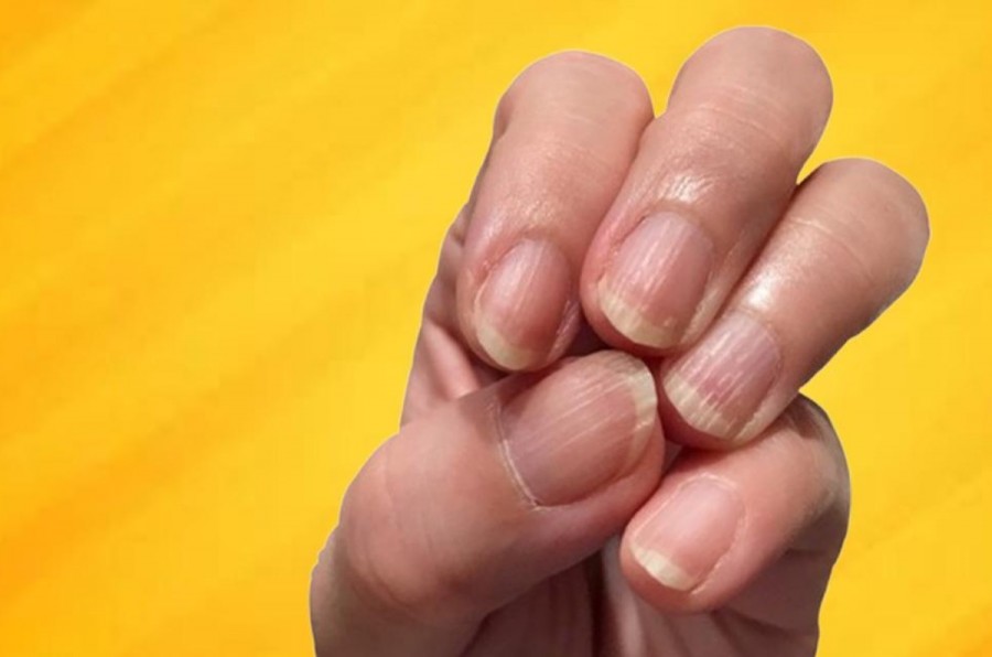 خطوط روی ناخن ها درباره سلامتی شما چه می گویند؟