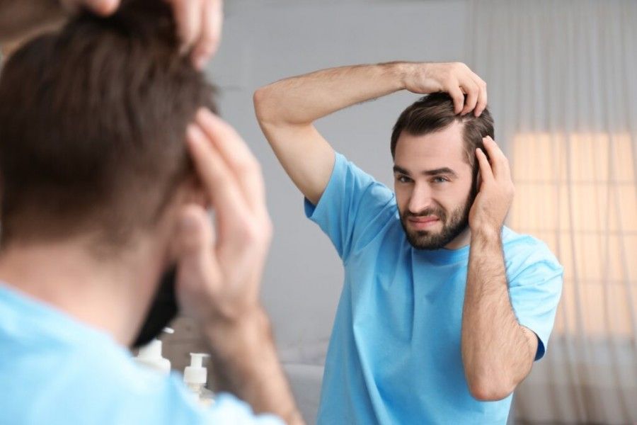 علت واقعی ریزش مو در جوانان چیست؟ 
