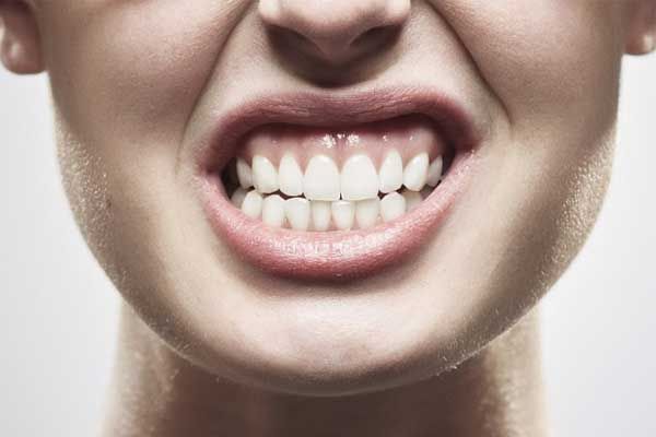 اروژن دندان یا سایش دندان 