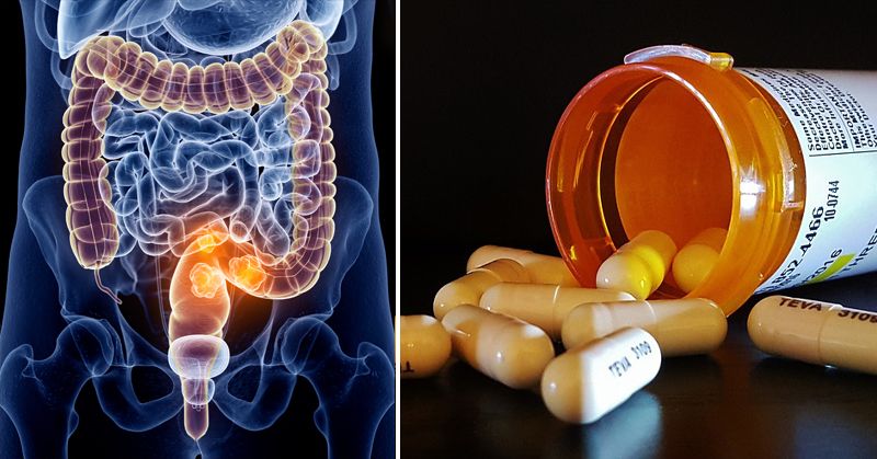 مصرف بیش از حد و طولانی مدت آنتی بیوتیک ها و ارتباط آن با سرطان روده ی بزرگ
