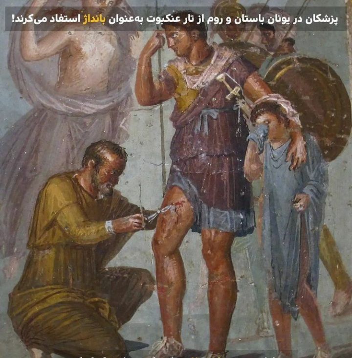 بانداژ زخم با تار عنکبوت از دوران یونان باستان تا یافته های جدید پزشکی در این باره