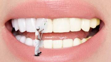 چگونه لکه های روی دندان را پاک کنیم؟ 10 راه ساده برای از بین بردن لکه از روی دندان