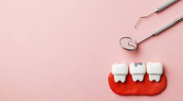 آمالگام و کامپوزیت: تفاوت‌ها و کاربردهای آن‌ها در ترمیم دندان