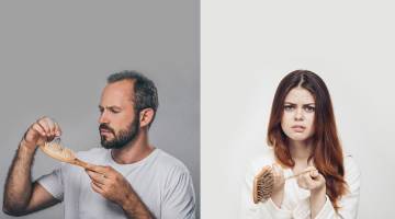 علت واقعی ریزش مو در جوانان چیست؟ راه‌ حل‌ ها و باورهای اشتباه